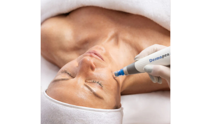 Microneedling in Geelong: Why Your Skin Loves a Little Controlled Chaos