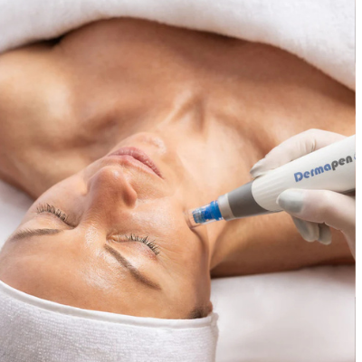 Microneedling in Geelong: Why Your Skin Loves a Little Controlled Chaos
