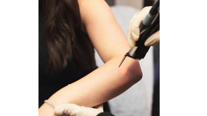 Laser Hair Removal During Pregnancy: Is It Safe?