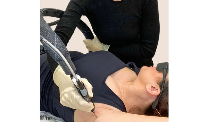 How Does Laser Hair Removal Work? Full Guide