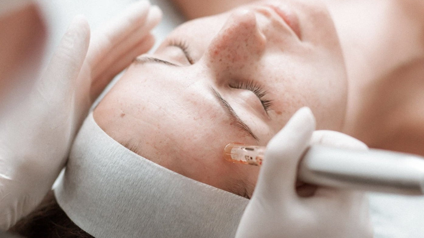 Skin Needling: A Rejuvenation Technique for Acne, Stretch Marks & Wrinkles - The Skin Boutique