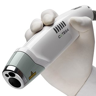 Laser Genesis™ by Cutera® - Lite - The Skin Boutique - Skin Treatment - The Skin Boutique