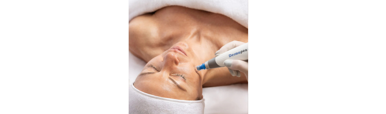 Microneedling in Geelong: Why Your Skin Loves a Little Controlled Chaos