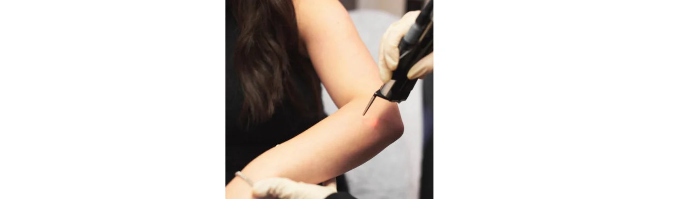 Laser Hair Removal During Pregnancy: Is It Safe?