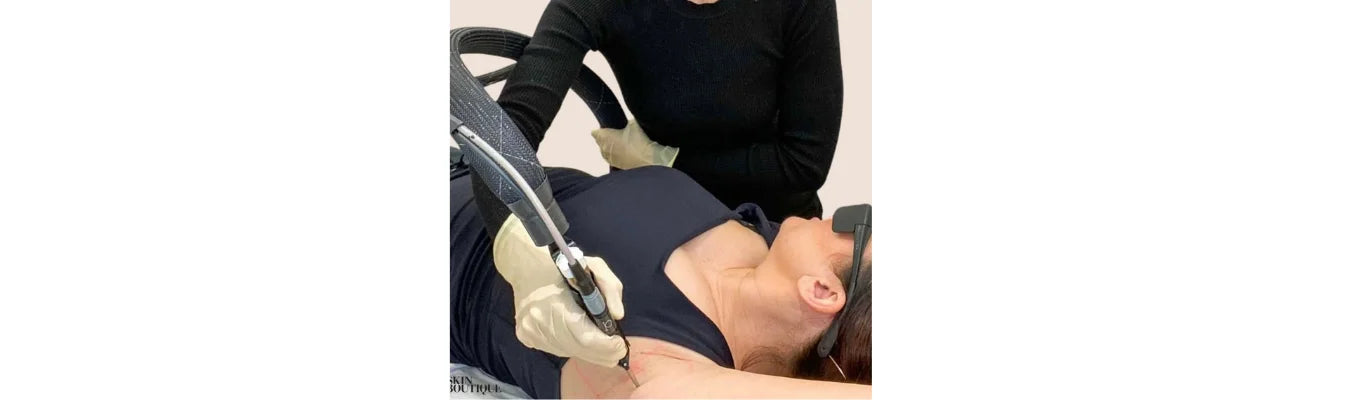 How Does Laser Hair Removal Work? Full Guide