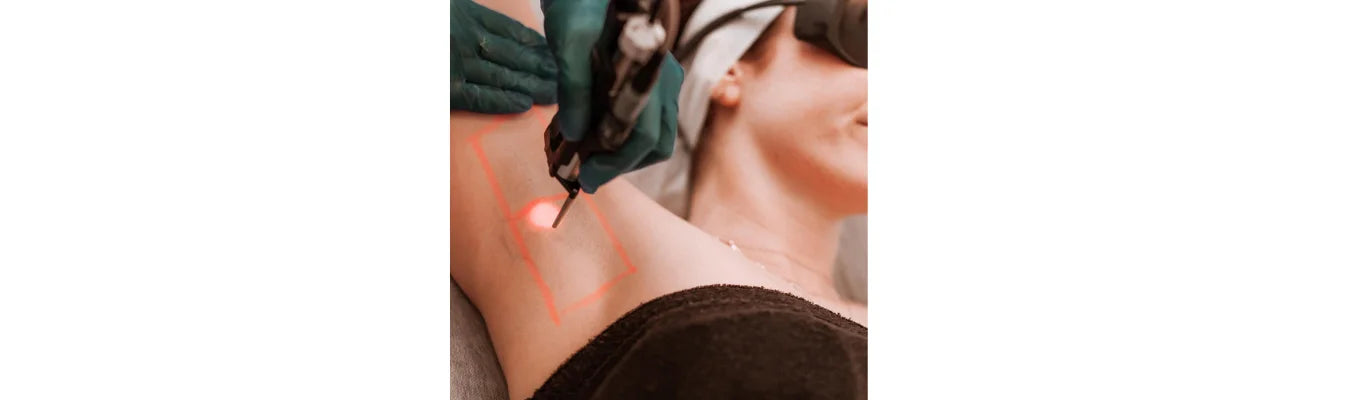 IPL vs Laser Hair Removal: Key Differences