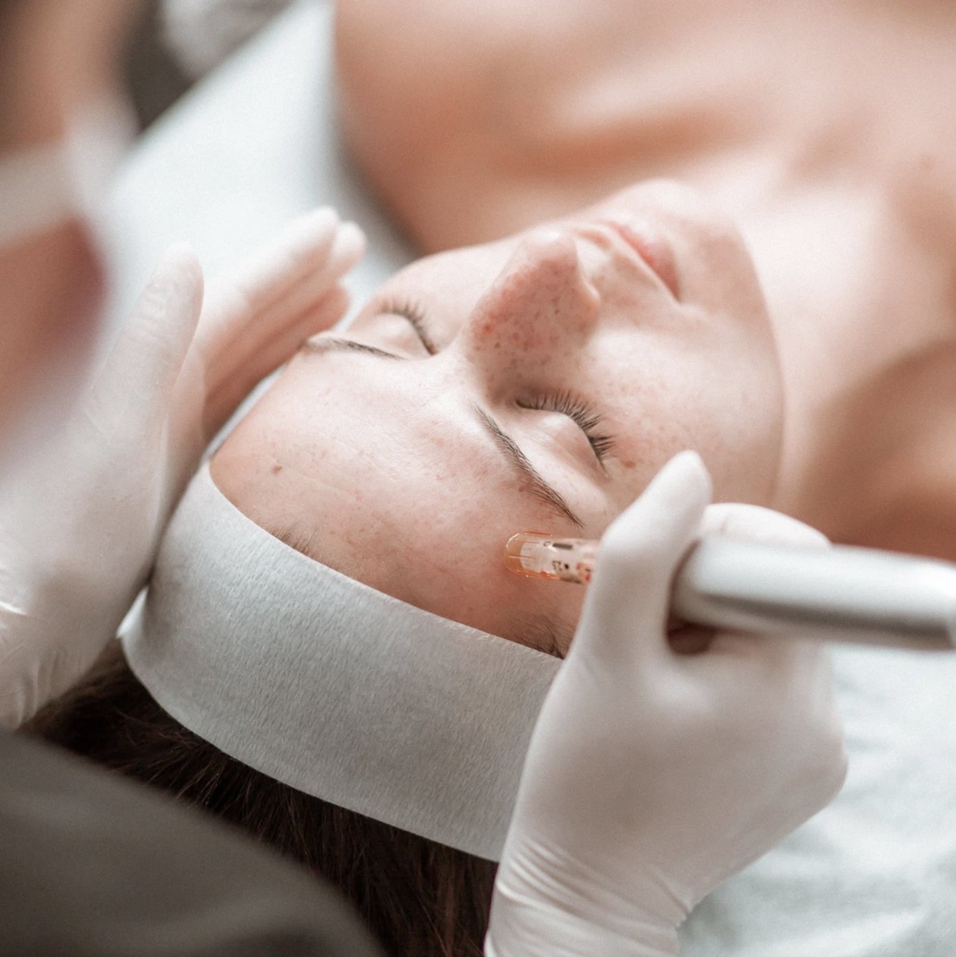 Skin Needling: A Rejuvenation Technique for Acne, Stretch Marks &amp; Wrinkles - The Skin Boutique