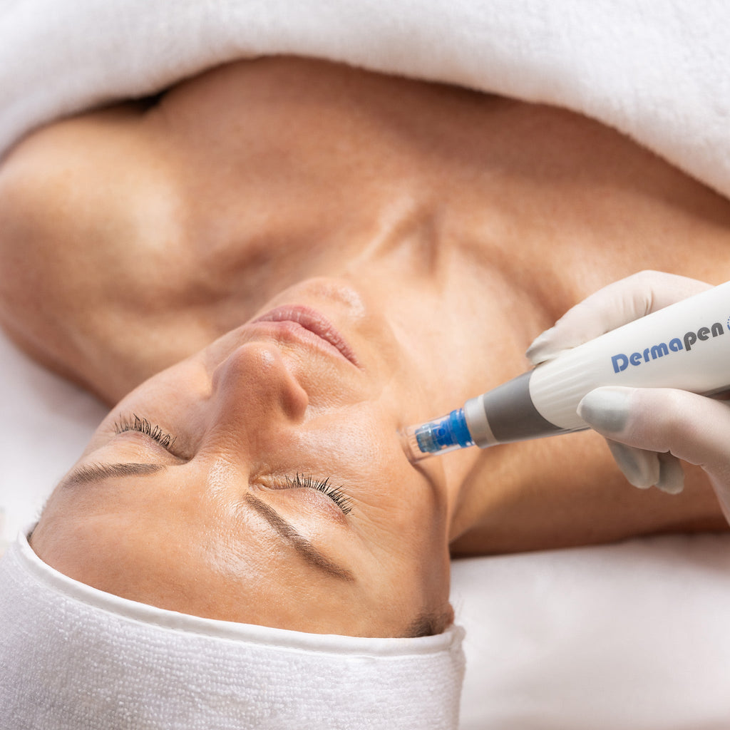 Skin Needling - for Volume Loss - Medical Face Single - Dermapen Pen 4™ - Skin Treatment - The Skin Boutique