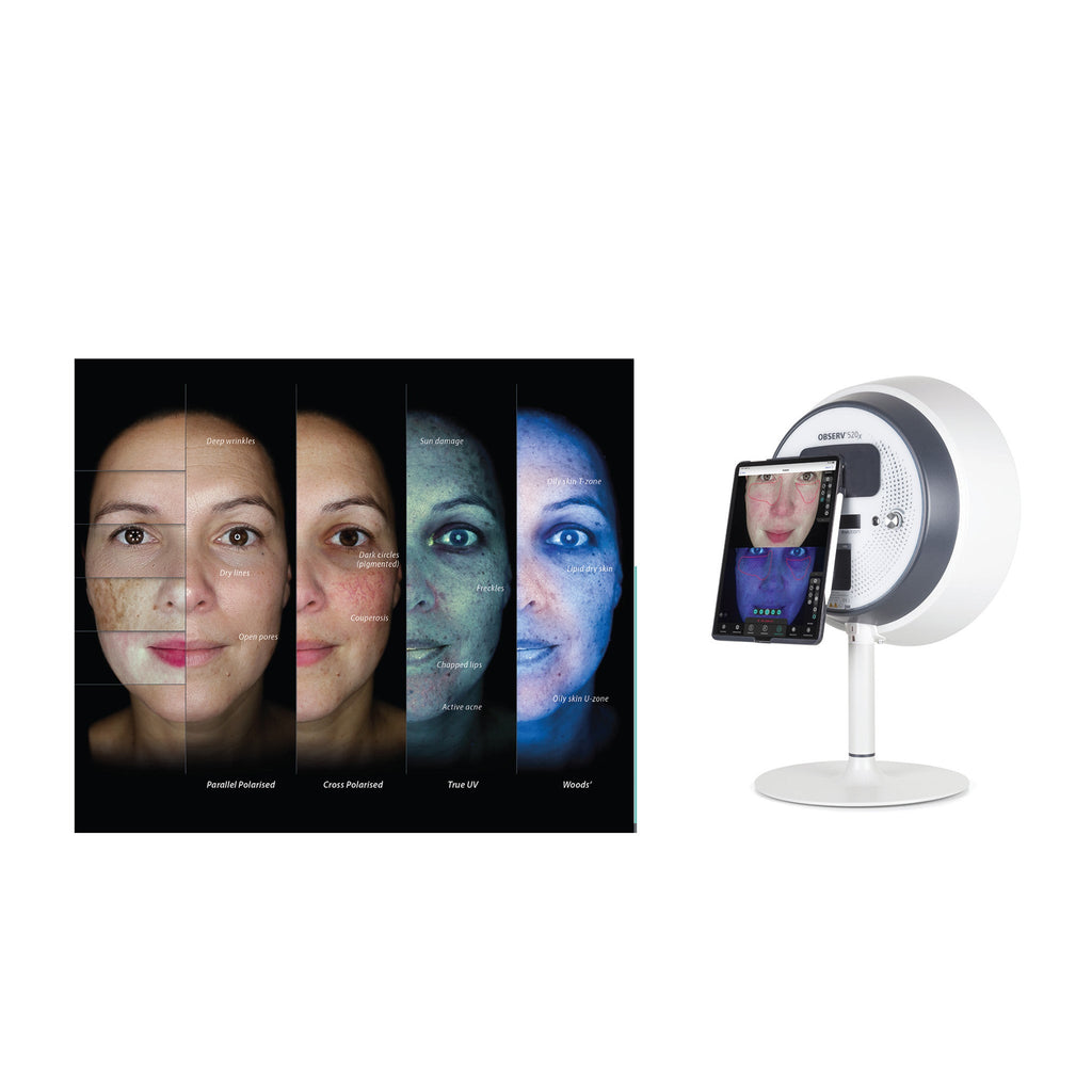 OBSERV ®520 - Skin Analysis System - OBSERV ®520 - Skin Treatment - The Skin Boutique