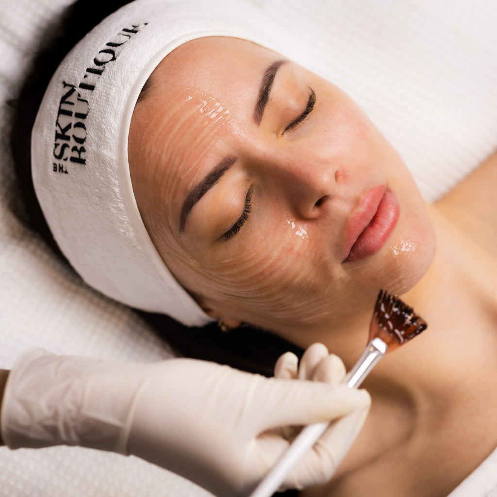 a melapeel forte from dermaceutic being performed to reduce the appearance of melasma, even skin tone and improve skin radiance.