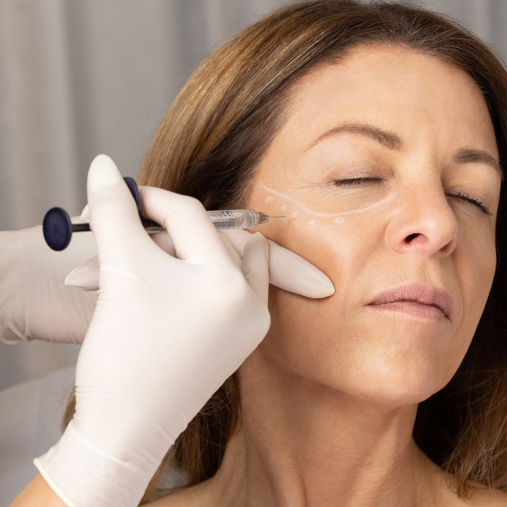 Bio - Remodelling - for Ageing - The Skin Boutique - Cosmetic Injections - The Skin Boutique