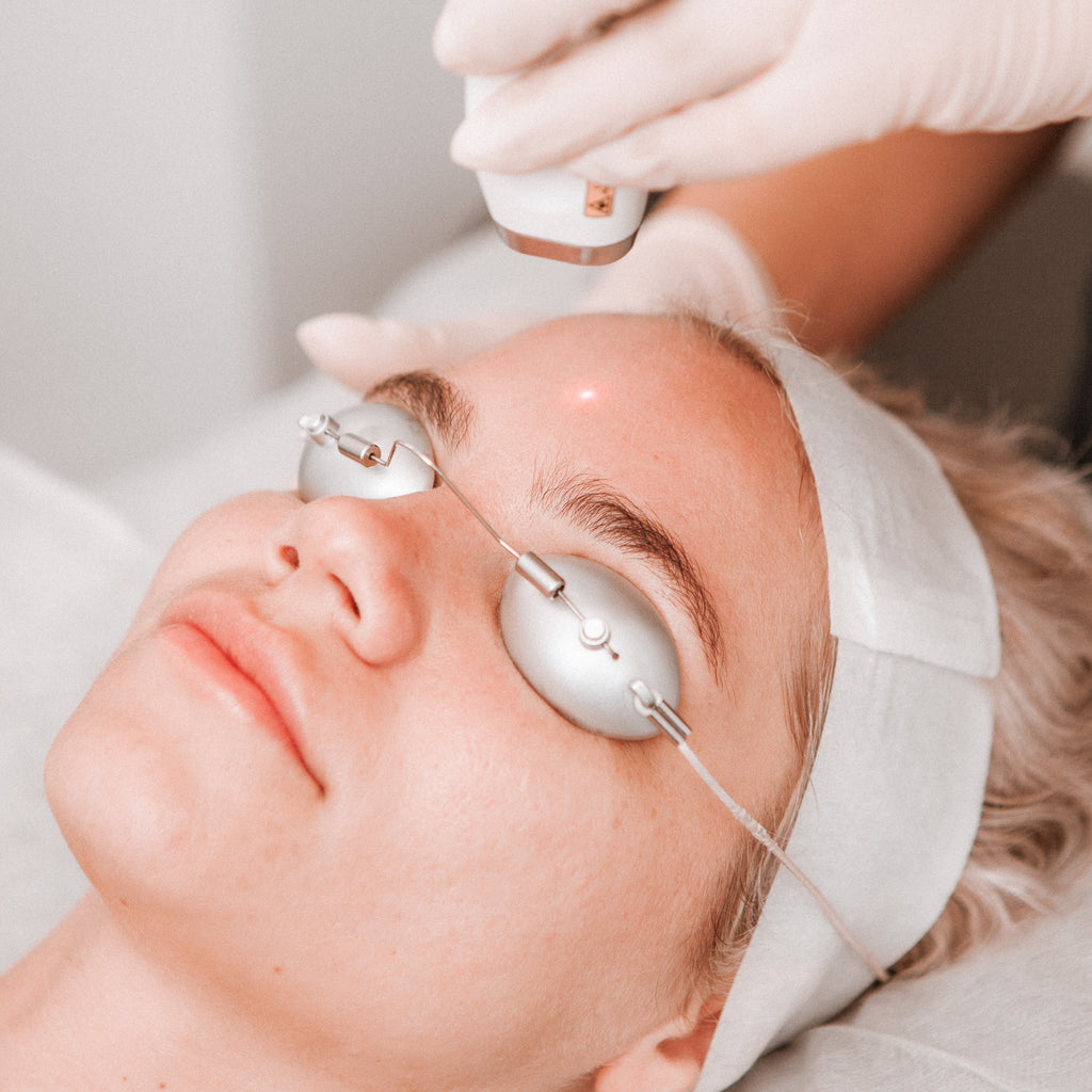 Laser genesis by cutera being performed to reduce redness and rosacea, shrink enlarged pores and restore a more radiant looking skin.