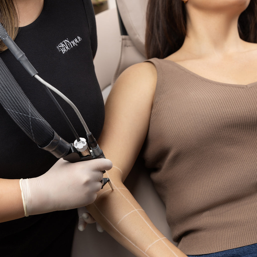 Laser Hair Removal 70% OFF (Newtown Exclusive Offer) - Face Chin - The Skin Boutique - Laser Hair Removal - The Skin Boutique