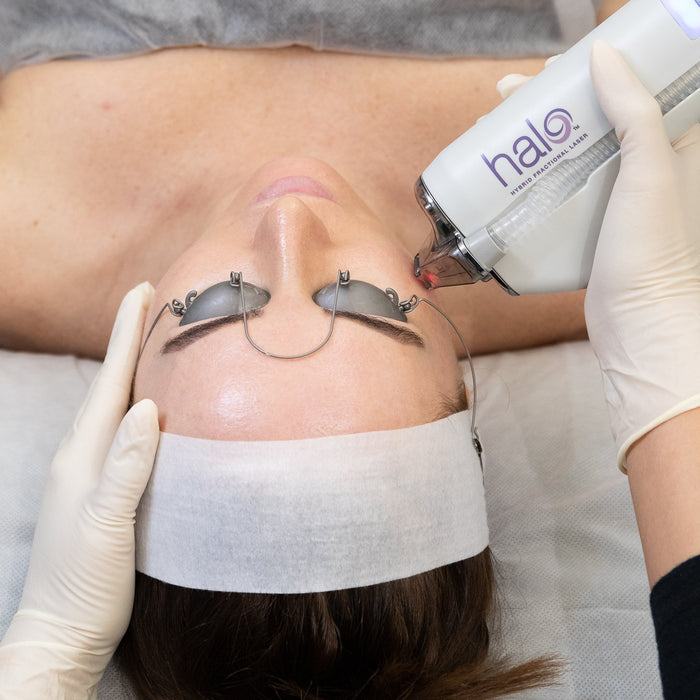 Halo™ – Hybrid Fractionated Laser